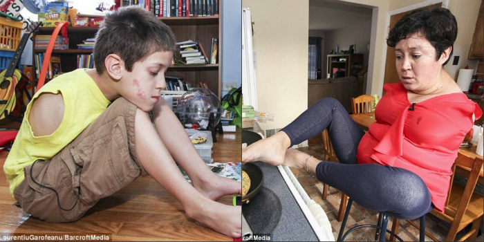 Մայր ու որդի ծնվել են առանց ձեռքերի, բայց ապրում են սովորական կյանքով (լուսանկարներ)