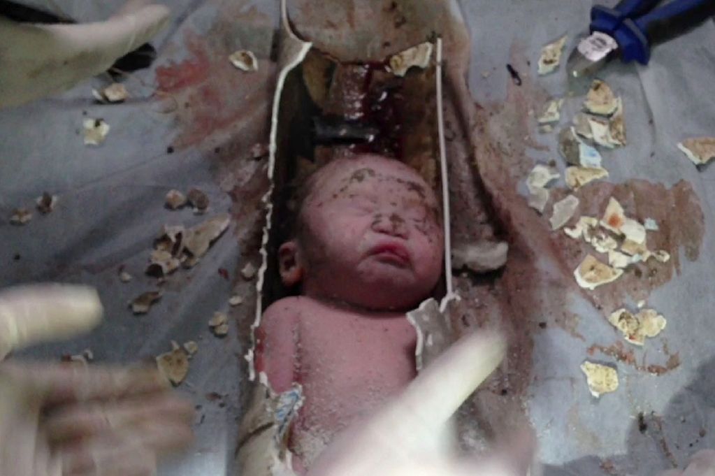 764d2ff8070b02f930bbNewborn-baby-rescued-in-China.jpg